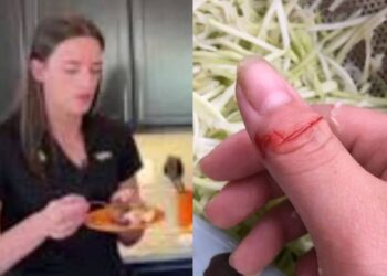 Kitchen Mishap Star Athlete Caitlin Clark..